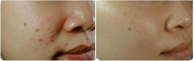 -SKINIST丽铂医疗美容