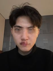 体验前-上海首尔丽格医疗美容医院