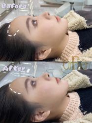 -OnFaer.纹眉半永久无创洗眉