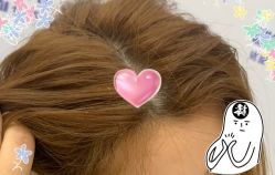 -大麦微针植发全国连锁