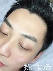点击看大图 -西施无菌半永久纹绣眉眼影唇轻增发纹发际线