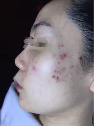-皇族养心堂·净痘·修敏·御颜