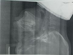 -浙江大学医学院附属口腔医院湖滨（延安）院区