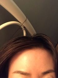 -洁铭新加坡医美