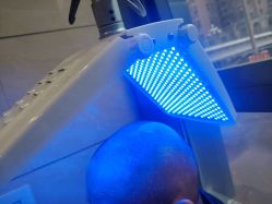 -碧莲盛·不剃发植发