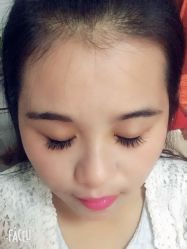 -初樱科技美学问题肌修复中心