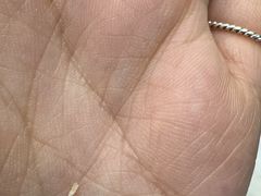 -Andrew指甲专科灰指甲·甲沟炎矫正·3D步态矫形鞋垫定制(上海法华镇路旗舰店)