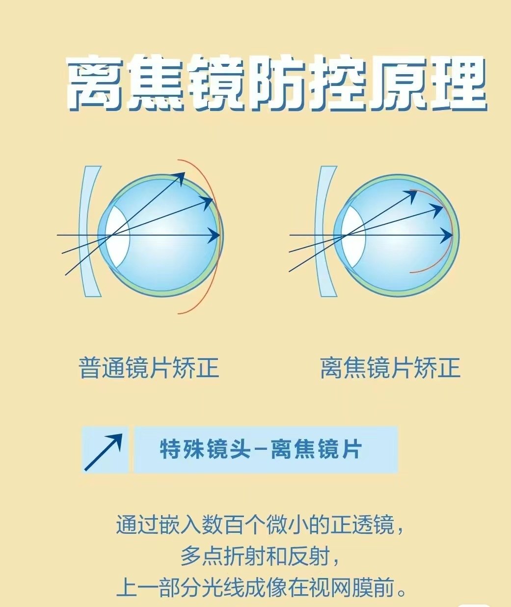 离焦镜片的原理