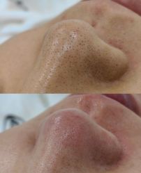 -禾壹净·素颜美问题肌肤修护中心