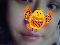 术后两天-上海华安整形外科门诊部