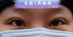 -八大处整形