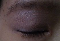 35天-上海华安整形外科门诊部