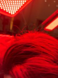 -碧莲盛·不剃发植发