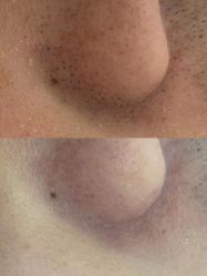 -蕾特恩专业祛痘·皮肤管理