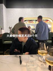 体验后-大麦微针植发全国连锁