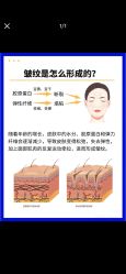 -克丽缇娜
