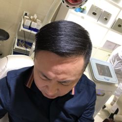 -大麦微针植发全国连锁