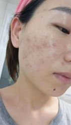 -蕾特恩专业祛痘·皮肤管理