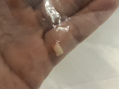 -同步齿科·数字化正畸种植口腔中心(珠海店)