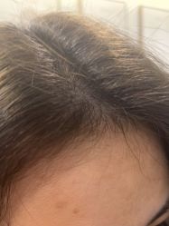 -熙朵美学植发连锁