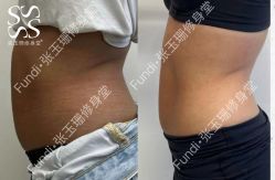 -Fundi张玉珊修身堂·indiba·BTL科技瘦身