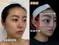 -Yestar重庆艺星医疗美容医院