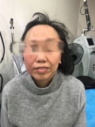 -八大处整形