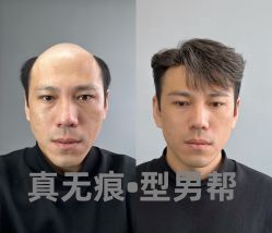 -型男帮男士假发补发·佩戴式发型