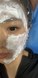 体验前-小忠丽格医美
