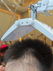 -碧莲盛·不剃发植发