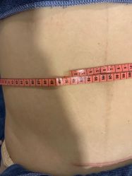 -蓝丝带产后恢复中心(于洪店)