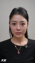 -Yestar重庆艺星医疗美容医院