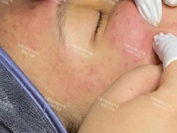 -Cream88颜皮肤管理中心