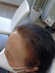 -新生植发·植养护一体