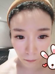 点击看大图 -大麦微针植发丨全国连锁