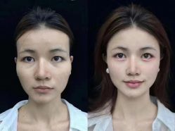 -YESIDO椰岛美容