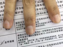 -Andrew指甲专科灰指甲·甲沟炎矫正·3D步态矫形鞋垫定制(浦三路店)