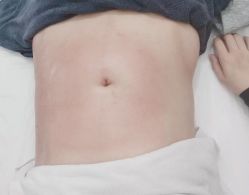 -Lily纤美·科技减脂中心