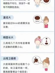 -清疣美疣·痣·斑净肤中心