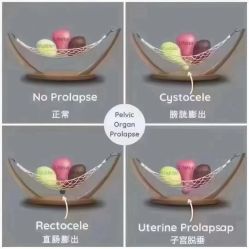 点击看大图 -U+YOGA优伽瑜伽·普拉提
