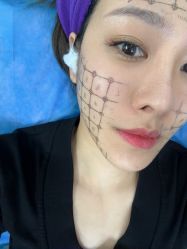 -广州美莱医疗美容医院
