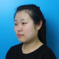 点击看大图 体验前-鑫元辰医疗美容整形