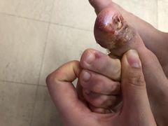 -郑远元专业修脚房(宣化路店)