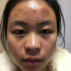 -+MS卓美丝专业祛痘·皮肤管理中心