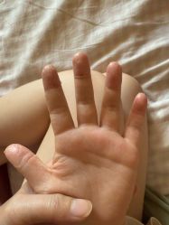 -首都儿科研究所附属儿童医院