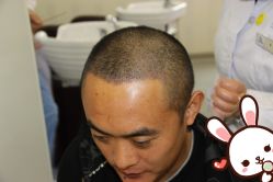 点击看大图 -大麦微针植发丨全国连锁