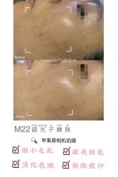 -E.beauty驻颜·痘敏肌调理中心