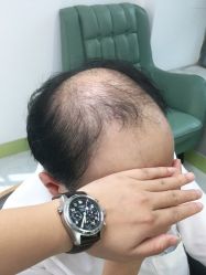 -发饰美男士增发补发假发定制店