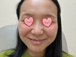 体验前-美莱医疗美容医院