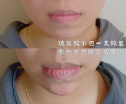 -上海漾颜医疗美容